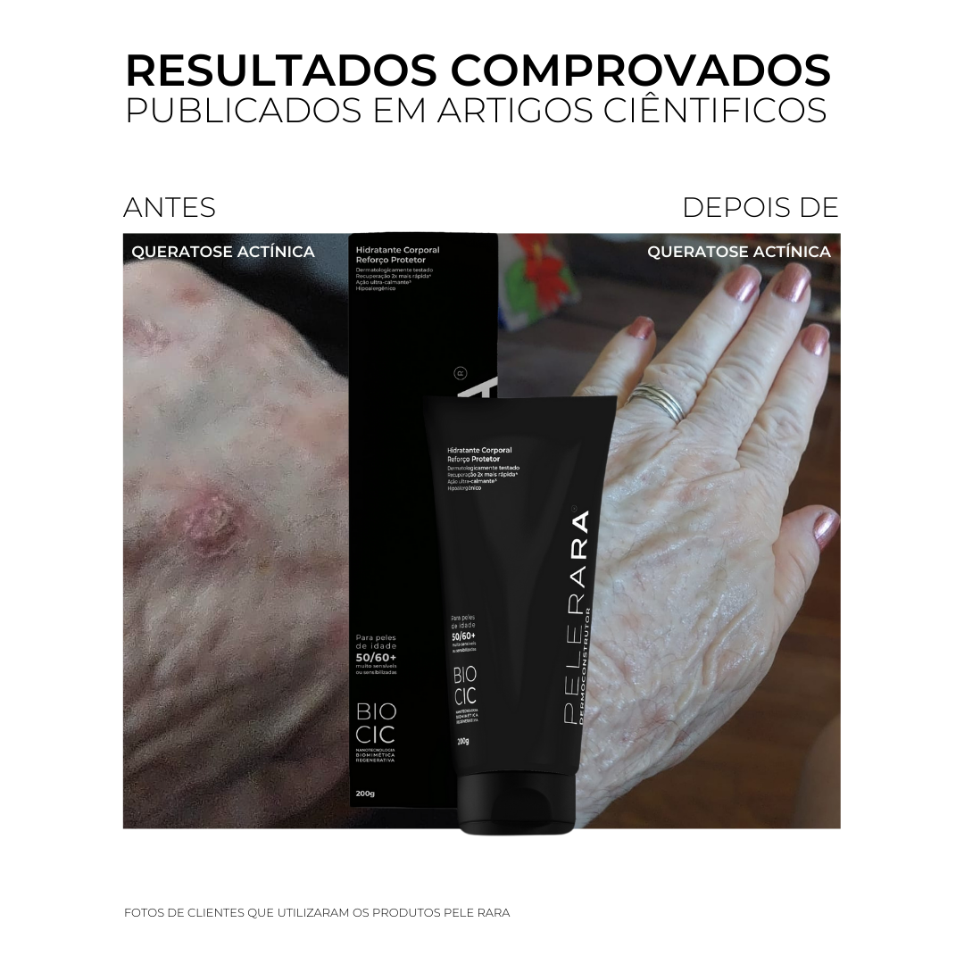 HIDRATANTE CORPORAL REFORÇO PROTETOR PELE RARA 200G