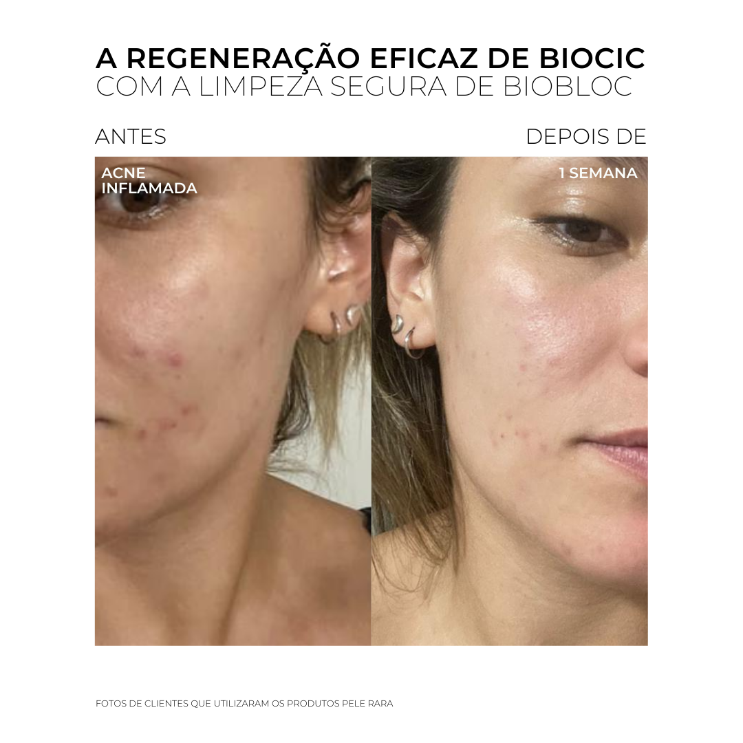KIT ESTÉTICA AVANÇADA