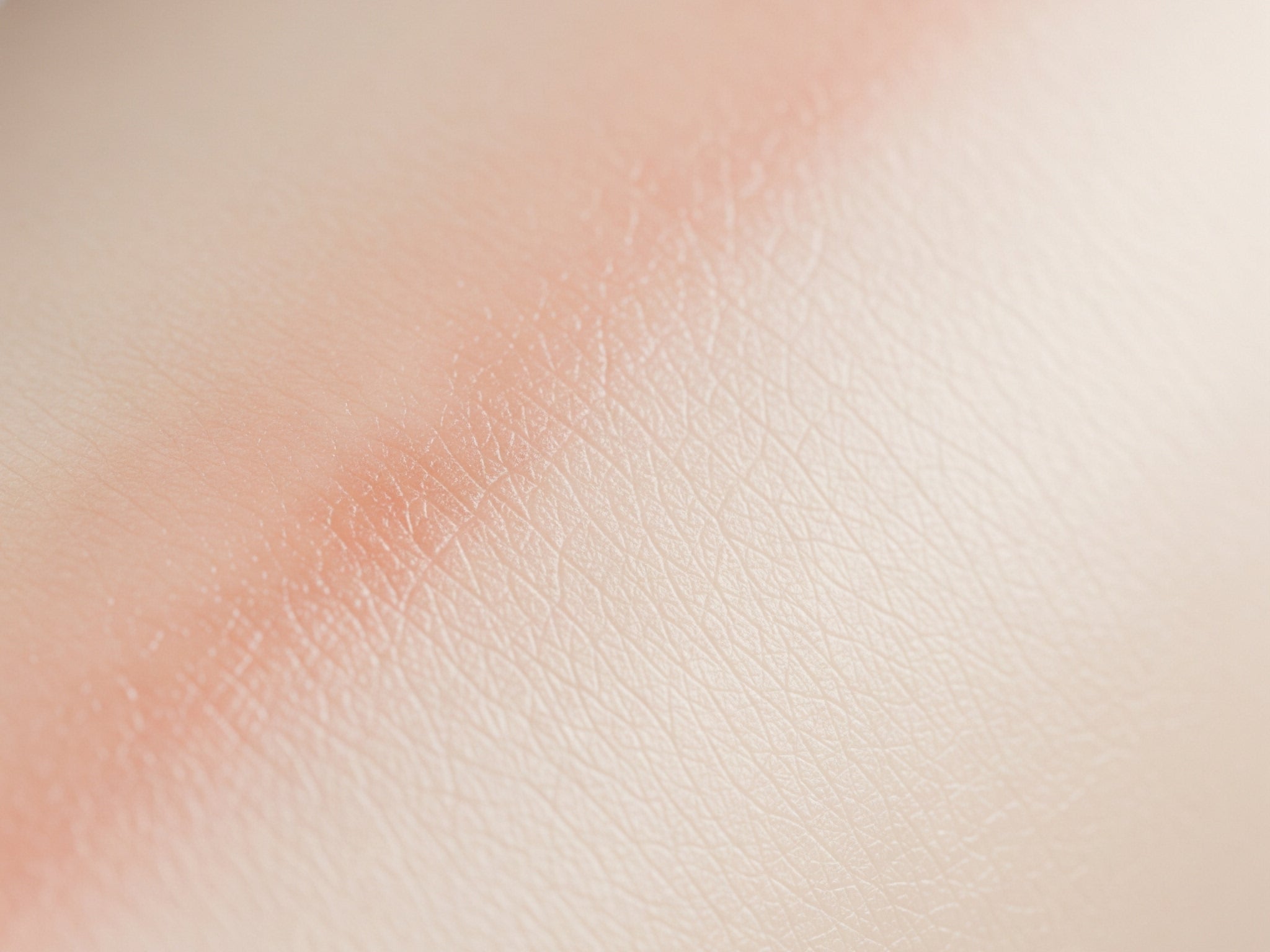 Diferenças entre lesões cutâneas de origem emocional e dermatológica